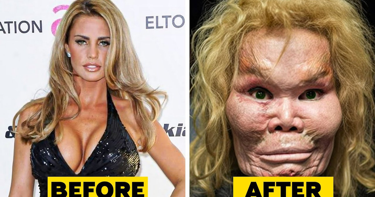 20 Celebrity Plastic Surgery Disasters: Why Money Can't Buy a Good Close-Up, Video thumbnail (max res)